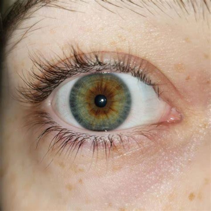 Are rainbow eyes real?