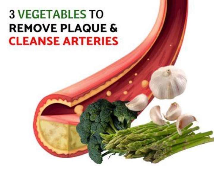 Can Apple cider vinegar remove plaque from arteries?