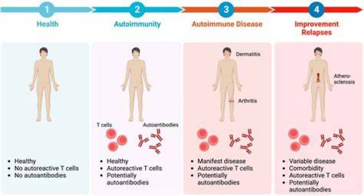 Can I take probiotics if I have an autoimmune disease?