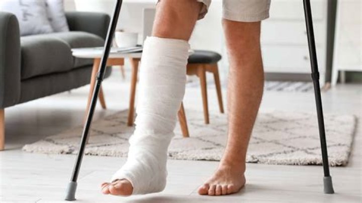 Can you break your legs while skiing?