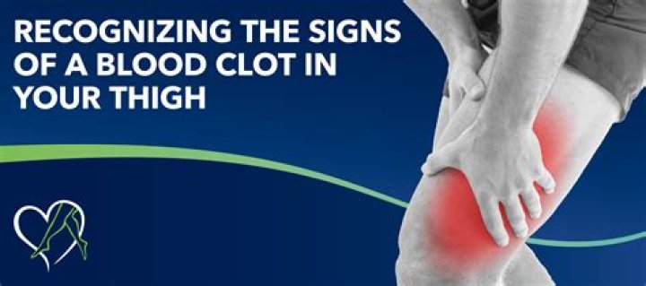 Can you feel a blood clot moving up your body?