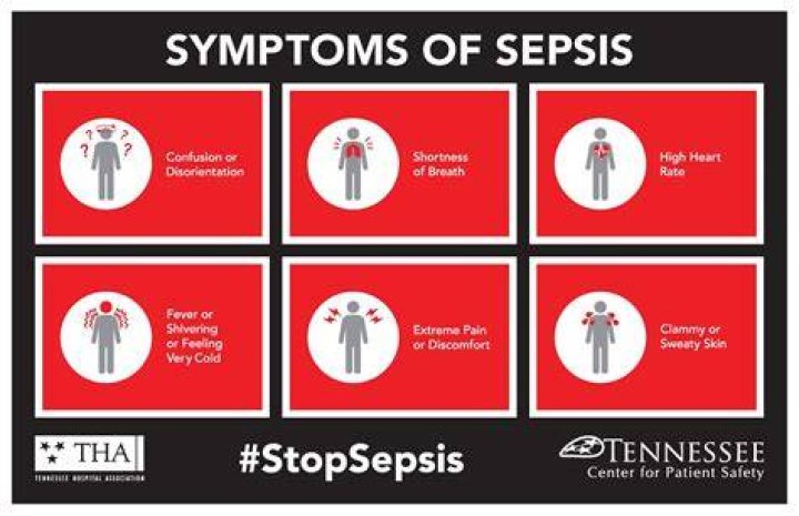 Can you have sepsis and not know it?