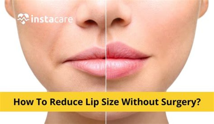 Can you reduce lip size?