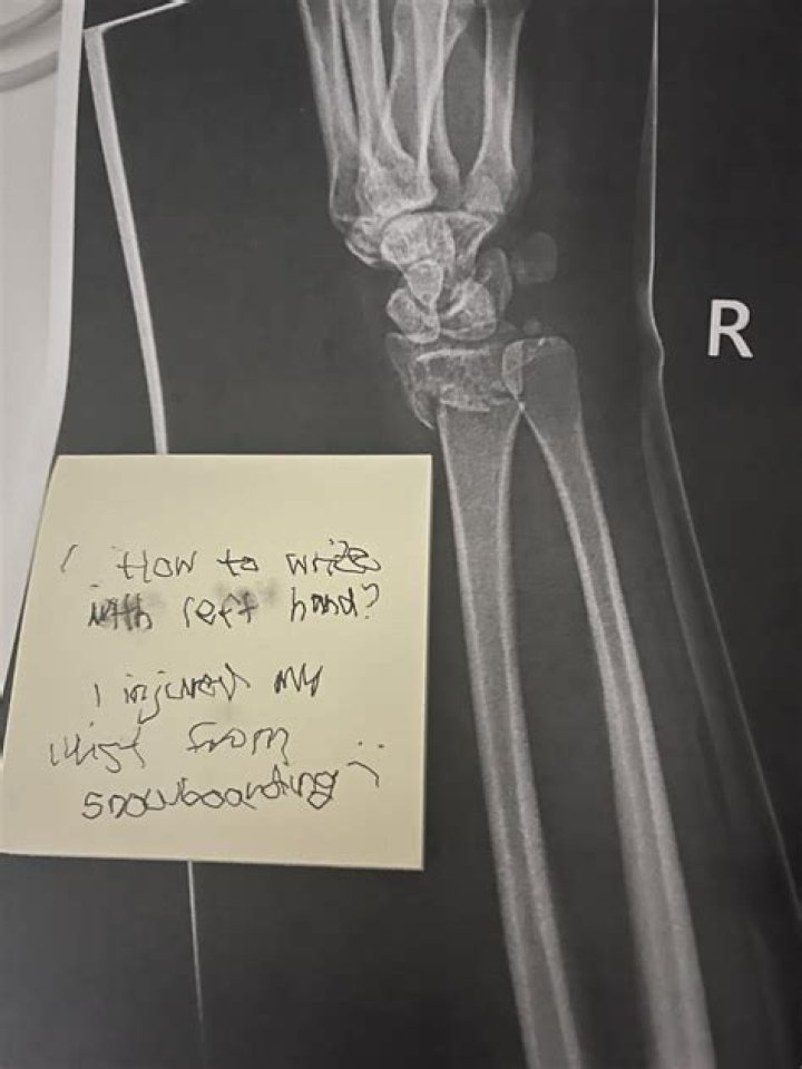 Did Artur Sitkowski break wrist?