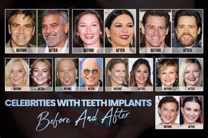 Do celebrities have life coaches?