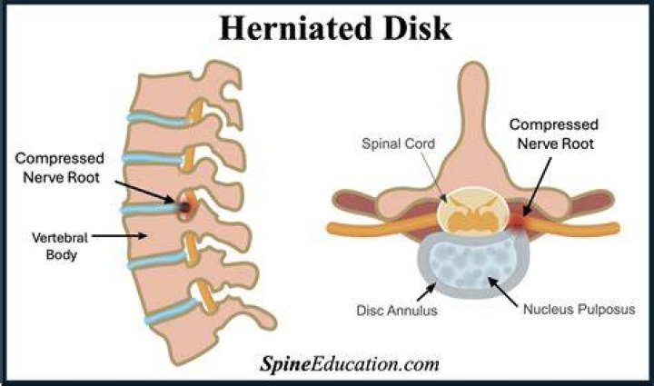 Do faster discs go further?