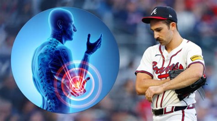 Do MLB pitchers arms hurt?