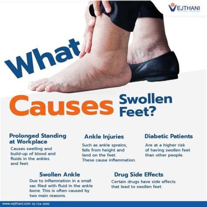 Does walking help reduce swollen ankles?