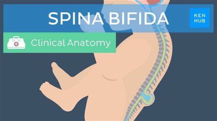How can I get bifidus?
