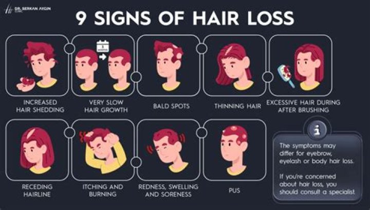 How do you know your losing your hair?