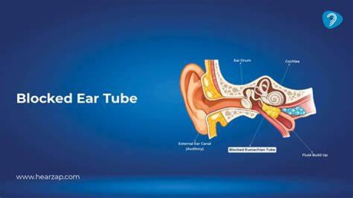 How do you open a blocked ear?