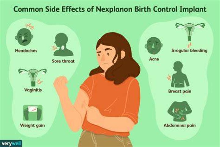 How long after 3 years does Nexplanon stop working?
