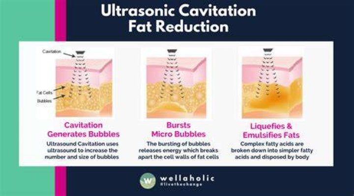 How long does it take for fat cavitation to work?