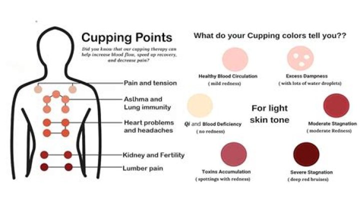 Is cupping good for smokers?