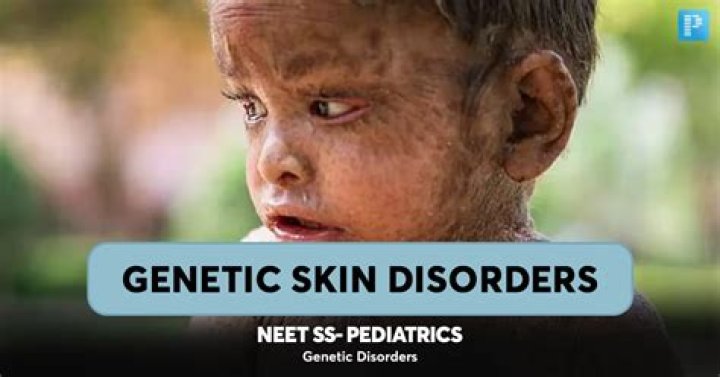 Is dry skin genetic?