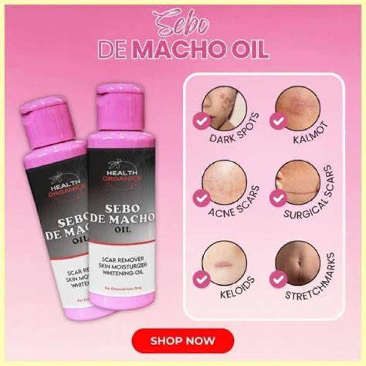 Is Sebo de Macho effective?