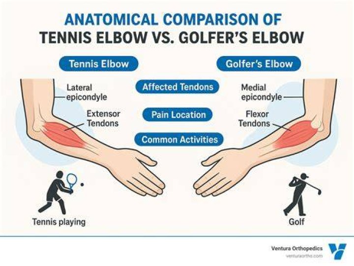 Should I learn golf or tennis?