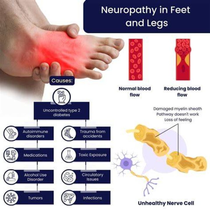 Should I take B12 if I have neuropathy?