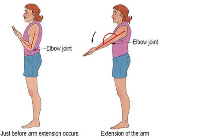 Should you tuck elbows in when putting?