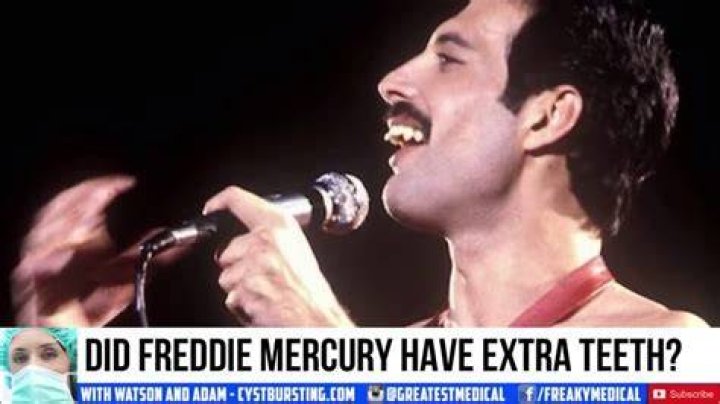 Was Freddie Mercury insecure about his teeth?
