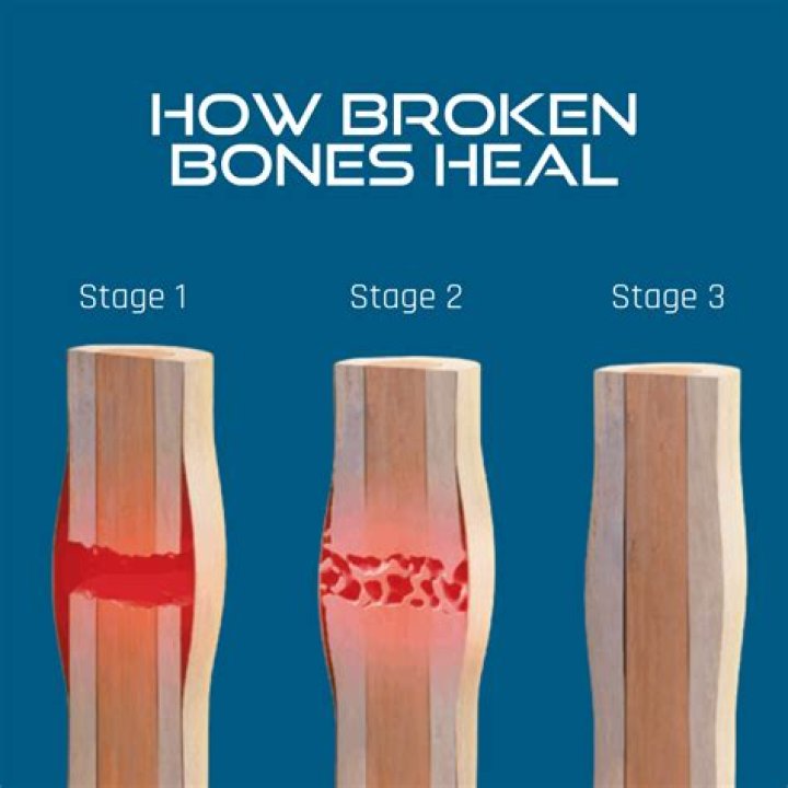 What's the hardest bone to heal?