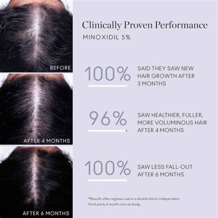 What age can you use minoxidil?