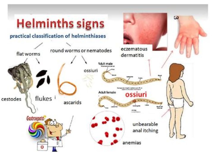 What are signs of roundworms in humans?