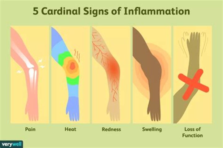 What are the 5 cardinal signs of inflammation?