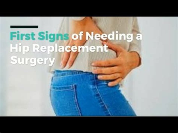 What are the first signs of needing a hip replacement?