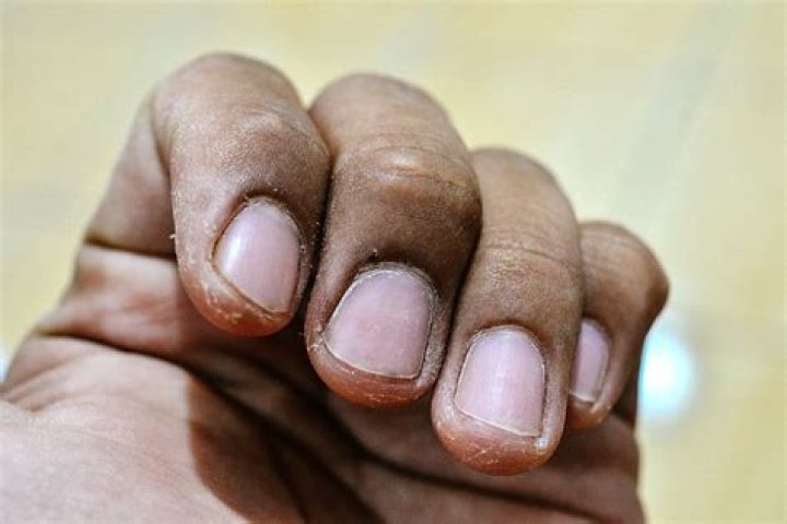 What does finger tape do?