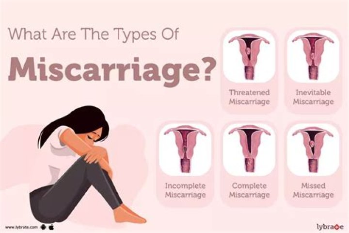 What does miscarriage discharge look like?