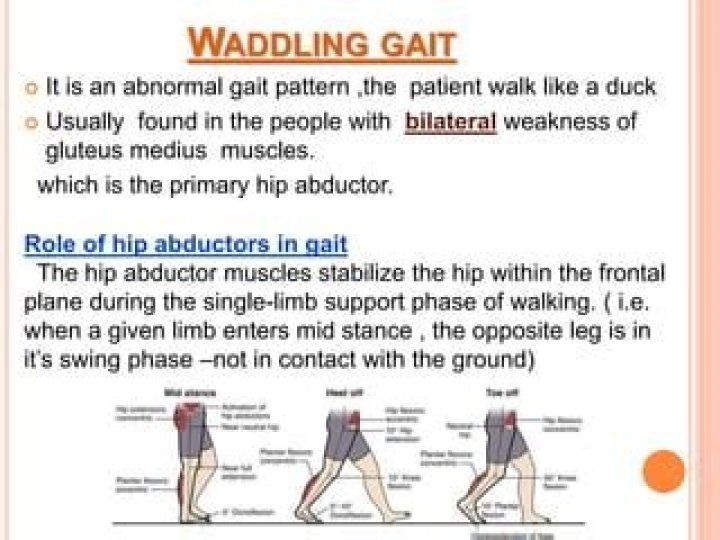 What does waddling gait mean?