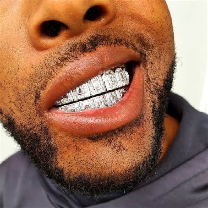 What is a grill for teeth?