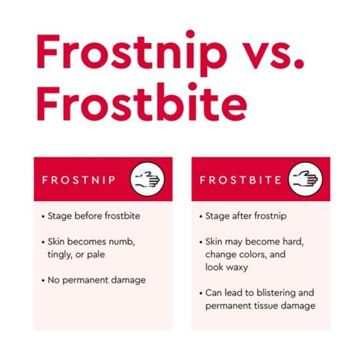 What is frost nip?