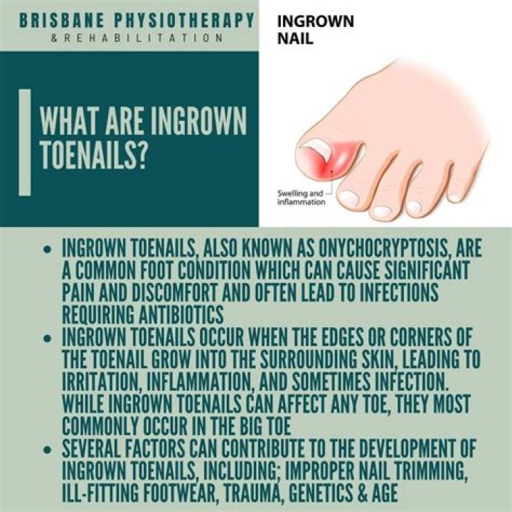 What is the fastest way to get rid of an ingrown toenail?