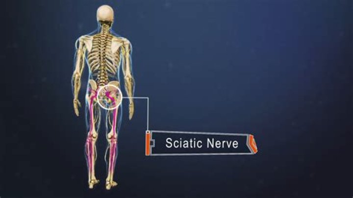 What is the largest nerve in the body?