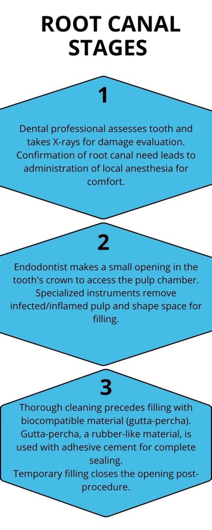 What is the second stage of root canal?