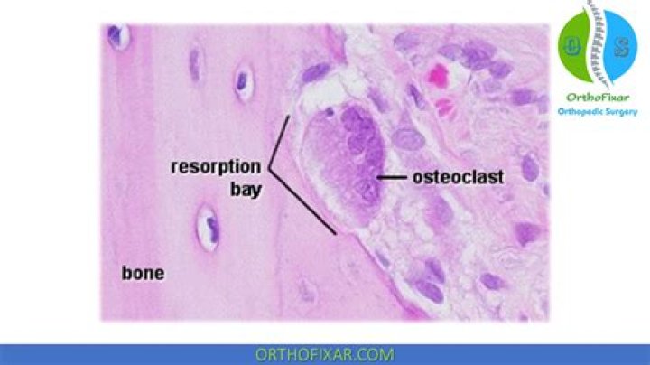 Where are osteoclast found?
