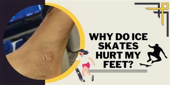 Why do figure skates hurt my feet?