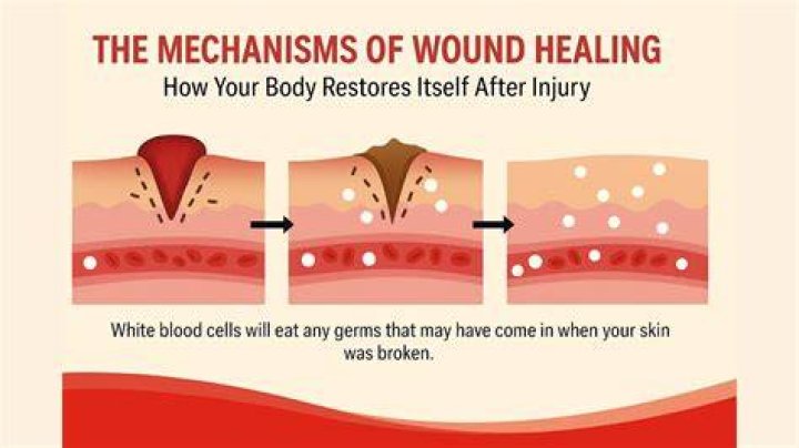 Why do nerves not heal?