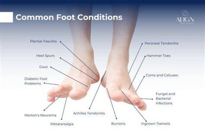 Why does my foot hurt by my toes?