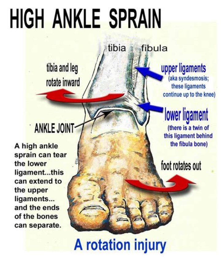 Why does my sprained ankle hurt at night?