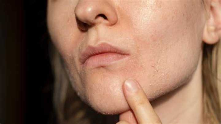 Why is my face so hairy as a woman?